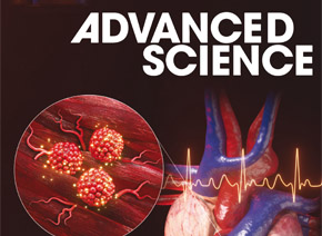 「輝駿客戶文章」Adv Sci ( IF=14.1 )｜RNA pull down試劑盒助力WTAP介導的m6A修飾促食管鱗癌機制研究